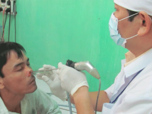 Con vắt béo núc ních sống trong mũi bệnh nhân 2