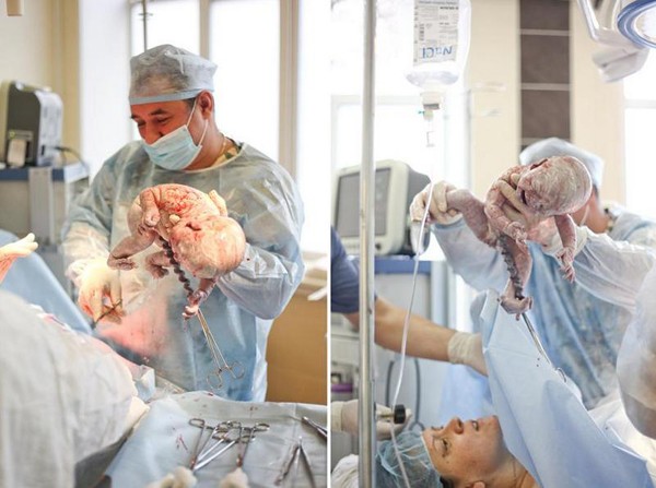 Chứng kiến tận mắt một ca sinh mổ 17