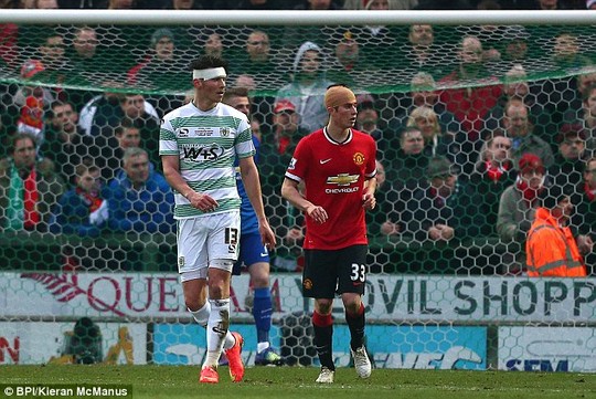 Cận cảnh pha bóng khiến cầu thủ trẻ của Man United bị rách đầu 4