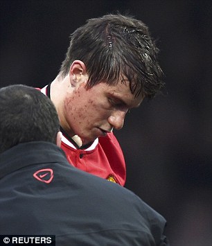Cận cảnh pha bóng khiến cầu thủ trẻ của Man United bị rách đầu 1