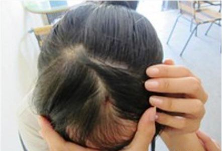 C&ocirc; gi&aacute;o đ&acirc;m b&uacute;t chảy m&aacute;u đầu học sinh bị xử l&yacute; nặng 1