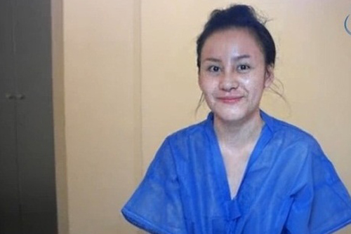 Gương mặt hot girl Việt “sưng phù” sau nghi án dao kéo 8