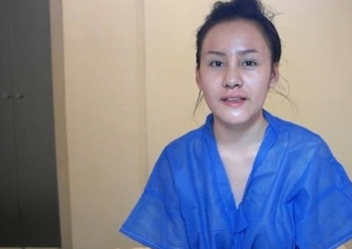 Gương mặt hot girl Việt “sưng phù” sau nghi án dao kéo 9