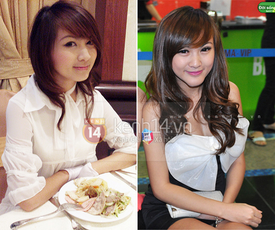 Gương mặt hot girl Việt “sưng phù” sau nghi án dao kéo 3