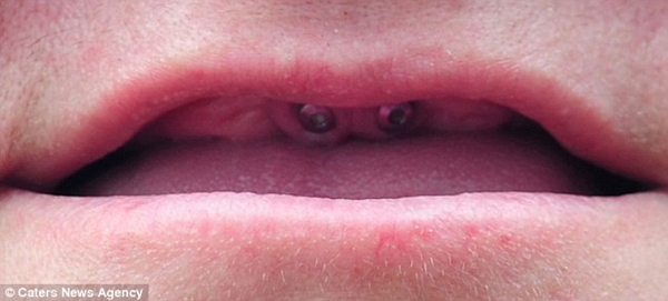 Những h&agrave;m răng kỳ lạ nhất "quả đất" 4