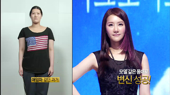 Bị ruồng bỏ, cô gái Hàn giảm 30kg và thẩm mỹ trở nên xinh đẹp 3