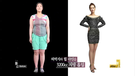 Bị ruồng bỏ, cô gái Hàn giảm 30kg và thẩm mỹ trở nên xinh đẹp 5