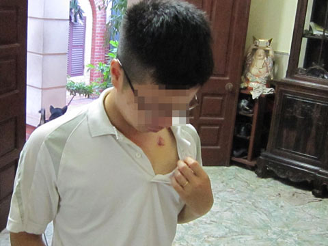 Em gái cho rằng Khôi nói mâu thuẫn, hàng xóm ý kiến trái chiều 3 Em gái cho rằng Khôi nói mâu thuẫn, hàng xóm ý kiến trái chiều 3