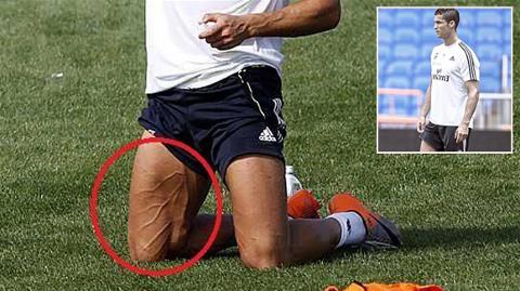 Ronaldo cố tình vén quần khoe chân cuồn cuộn cơ bắp 6