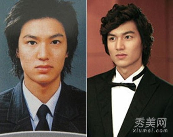 Lật tẩy những mỹ nam "vạn người mê" đã từng thẩm mỹ 5 Lật tẩy những mỹ nam "vạn người mê" đã từng thẩm mỹ 5