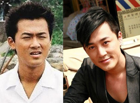 Lật tẩy những mỹ nam "vạn người mê" đã từng thẩm mỹ 7 Lật tẩy những mỹ nam "vạn người mê" đã từng thẩm mỹ 7