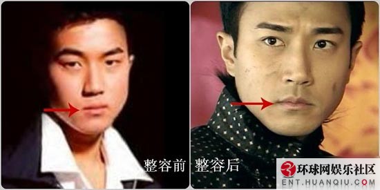 Lật tẩy những mỹ nam "vạn người mê" đã từng thẩm mỹ 10 Lật tẩy những mỹ nam "vạn người mê" đã từng thẩm mỹ 10