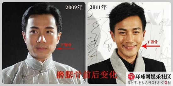 Lật tẩy những mỹ nam "vạn người mê" đã từng thẩm mỹ 11 Lật tẩy những mỹ nam "vạn người mê" đã từng thẩm mỹ 11