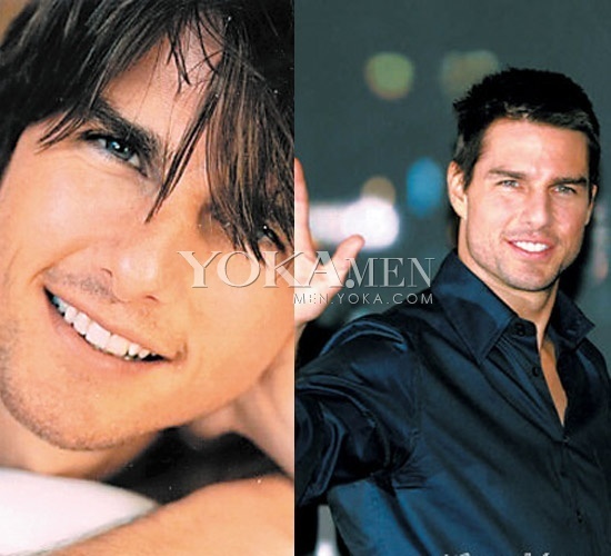 Lật tẩy những mỹ nam "vạn người mê" đã từng thẩm mỹ 18 Lật tẩy những mỹ nam "vạn người mê" đã từng thẩm mỹ 18