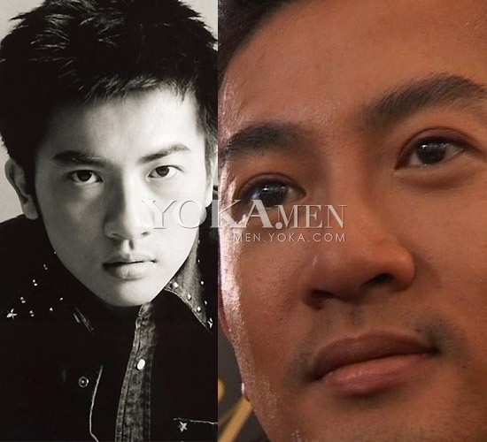 Lật tẩy những mỹ nam "vạn người mê" đã từng thẩm mỹ 8 Lật tẩy những mỹ nam "vạn người mê" đã từng thẩm mỹ 8