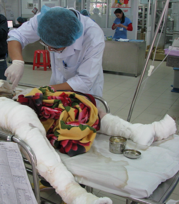 Cha của cô gái bị đốt kể về con gái 1