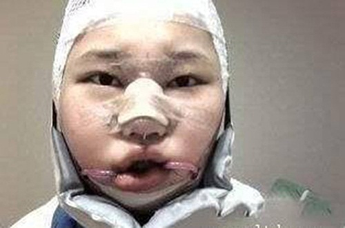 Giới trẻ Trung Quốc đua nhau "cắt gọt" mặt mũi 1