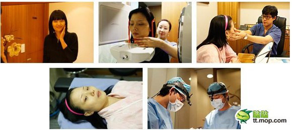 Hành trình phẫu thuật thẩm mỹ "vịt hóa thiên nga" của cô gái Hàn Quốc 2