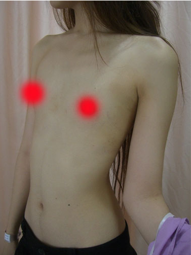 Ngỡ ngàng cô gái Thái Lan "vịt hóa thiên nga" sau 5 ca phẫu thuật thẩm mỹ 5
