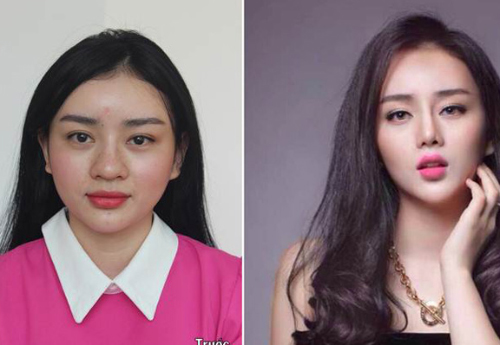 Những cô gái Việt lột xác thần kỳ nhờ phẫu thuật thẩm mỹ 15