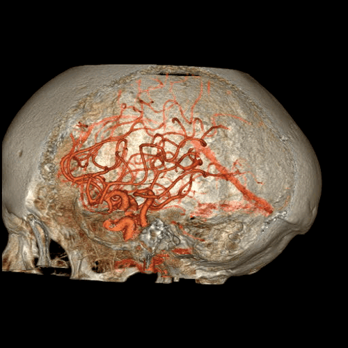 Xem ảnh chụp não, động mạch, tim "động đậy" trong cơ thể người 2