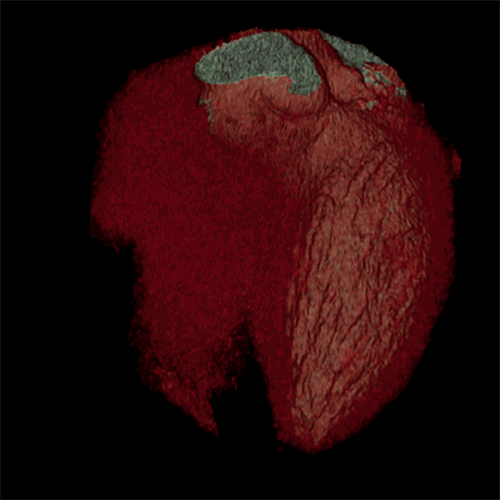 Xem ảnh chụp não, động mạch, tim "động đậy" trong cơ thể người 4
