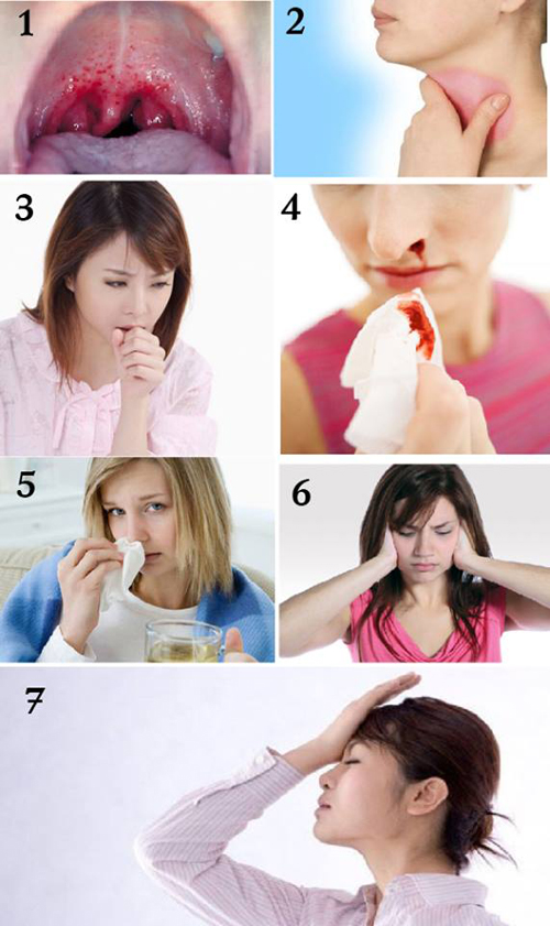 Xem nhanh điều cần biết để phòng tránh bệnh ung thư vòm họng 2