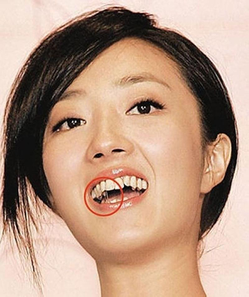 Những ngôi sao châu Á khổ sở vì sở hữu hàm răng xấu 8