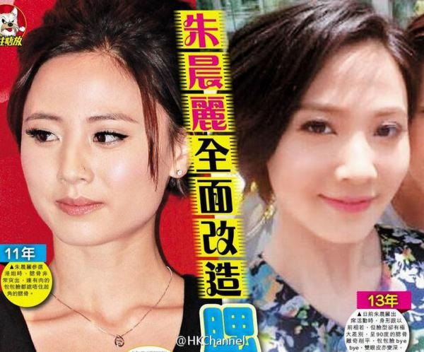 Cựu Hoa hậu Hồng Kông bị nghi gọt mặt 2