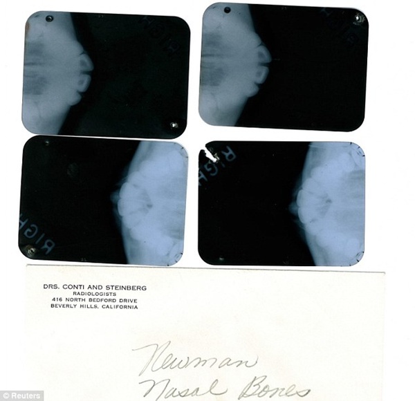 Đấu giá bằng chứng Marilyn Monroe phẫu thuật thẩm mỹ 7