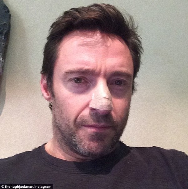 “Người sói” Hugh Jackman đang điều trị ung thư da 1