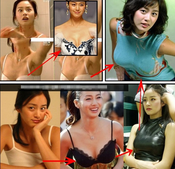 Rộ nghi vấn Kim Tae Hee sửa mắt, nâng ngực 2