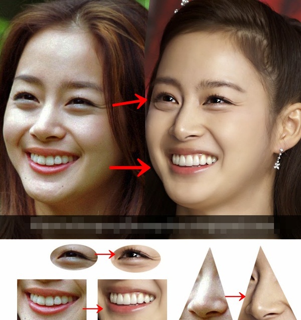 Rộ nghi vấn Kim Tae Hee sửa mắt, nâng ngực 4