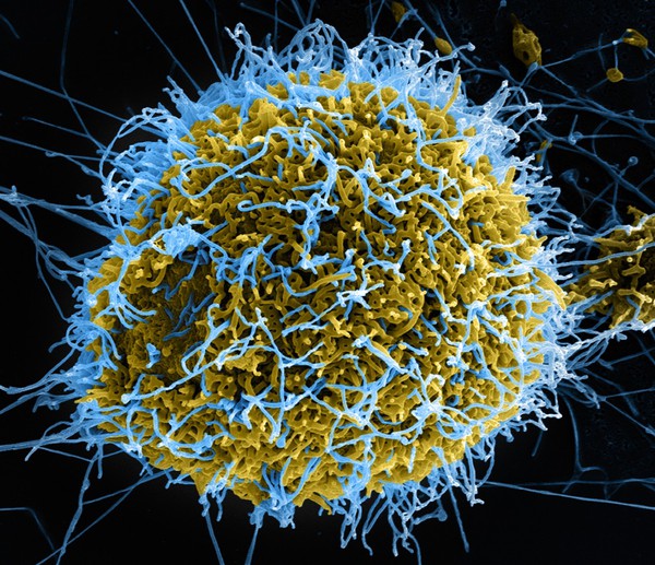 Những đặc điểm biến Ebola trở thành "virus ác quỷ" 8
