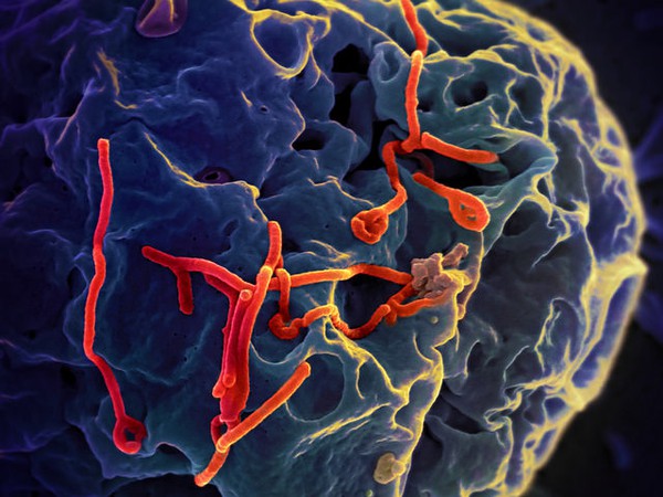 Cách tiêu diệt Ebola từ động vật "Batman" trong tương lai 7