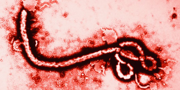 Thí nghiệm lý giải người nhiễm Ebola vẫn có khả năng sống sót 3