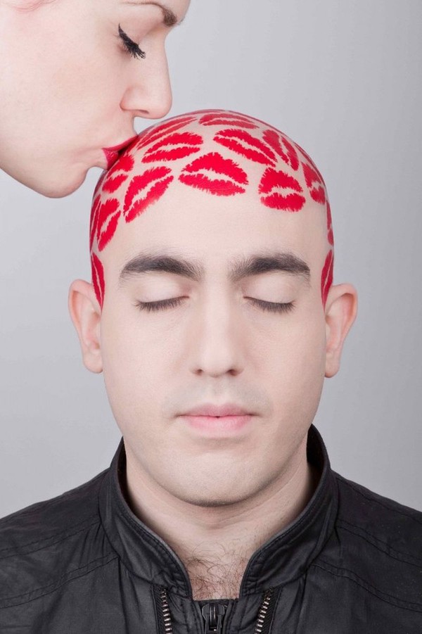 Phát hiện tế bào giúp chữa bệnh hói đầu trong cơ thể 6