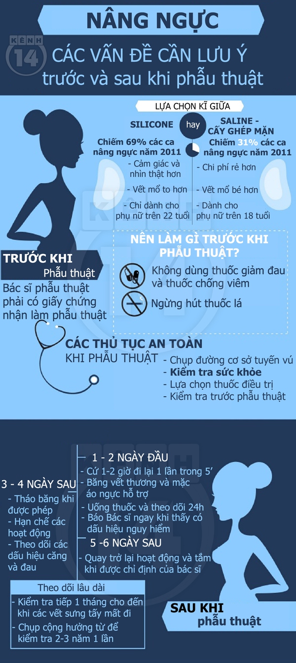 Lưu ý "đặc biệt" trước và sau phẫu thuật nâng ngực 1