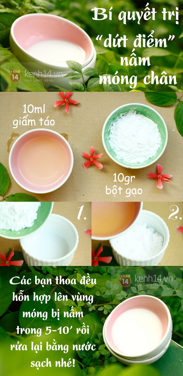 C&aacute;ch đơn giản để trị dứt điểm nấm m&oacute;ng ch&acirc;n 1