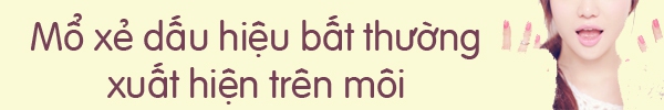 "Ngó nghiêng" chiếc lưỡi để đoán biết bệnh tật 2