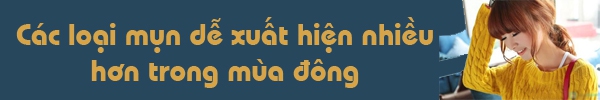 Thói quen ăn uống ngày lạnh khiến mụn mọc nhiều hơn 3