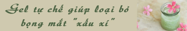 Gừng và sữa kết hợp giúp trị nhức đầu do viêm xoang 2