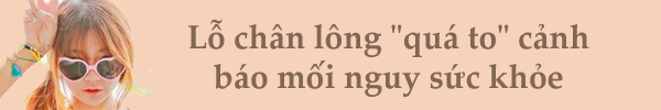 Làn da "trẻ mãi không già" nhờ 7 dưỡng chất tự nhiên 4