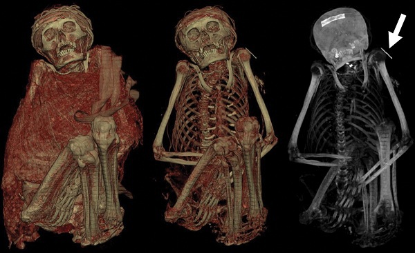 Các kỹ thuật ướp xác cổ quái từ 7.000 năm trước 5