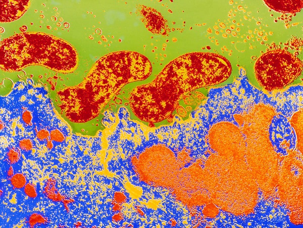 5 sự thật bất ngờ về vi khuẩn trong cơ thể bạn 6