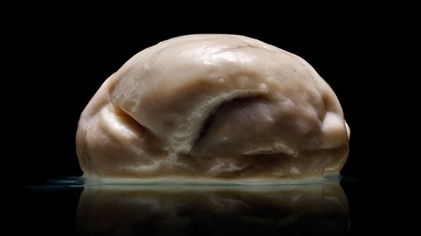 Hình ảnh bộ não người "phẳng" đến kỳ lạ mới được công bố 1