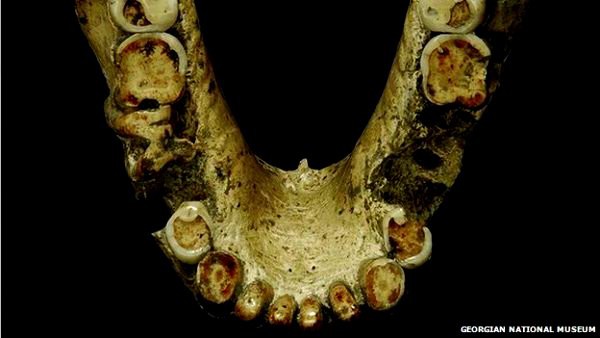 Bằng chứng cho thấy người cổ đại đã biết dùng tăm để "xỉa răng" 2