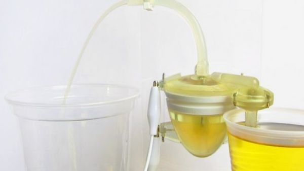 Kh&aacute;m ph&aacute; mới về c&ocirc;ng dụng "kh&oacute; tin" của nước tiểu  1