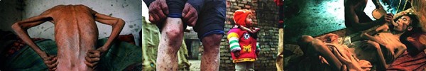 Cận cảnh sự t&agrave;n ph&aacute; của ung thư v&uacute; tới bầu ngực 19