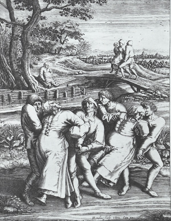 Những chứng bệnh "cuồng loạn" qu&aacute;i gở trong lịch sử 6